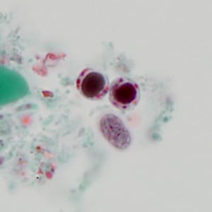 Case320_B.jpg