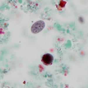 Case320_C.jpg