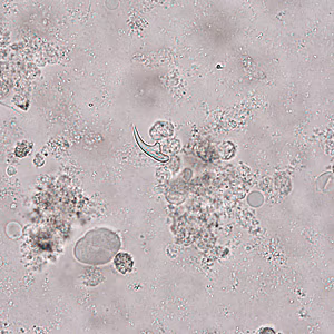 Case321_A.jpg