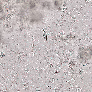 Case321_B.jpg