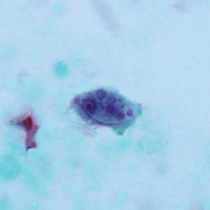 Case322_A.jpg