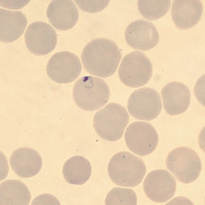 Case323_A.jpg