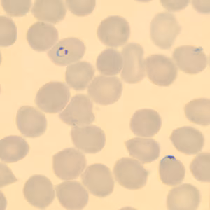 Case323_B.jpg