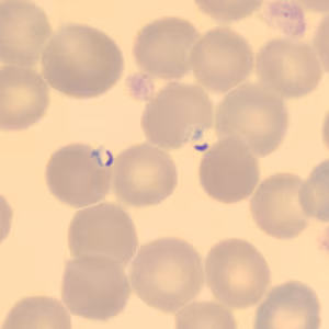 Case323_C.jpg