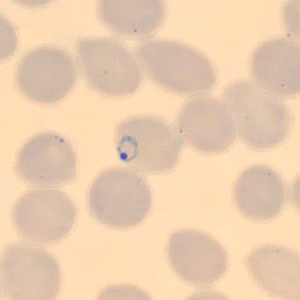 Case323_D.jpg