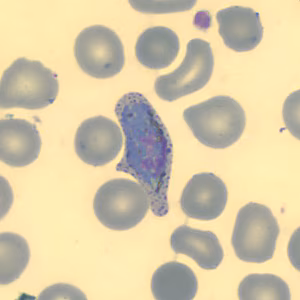 Case323_H.jpg
