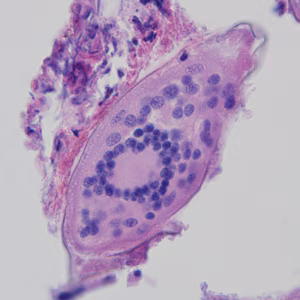 Case324_B.jpg