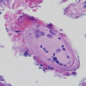 Case324_C.jpg