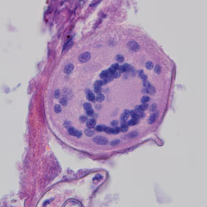 Case324_D.jpg