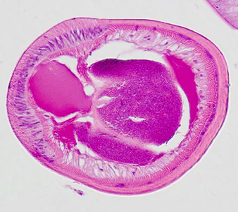 Case326_D.jpg
