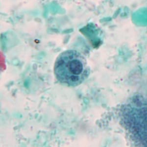 July - 2012 - Case #327