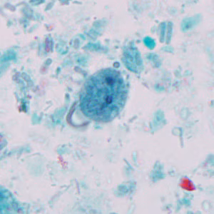 Case327_C.jpg