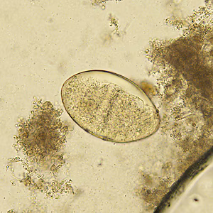 Case329_B.jpg