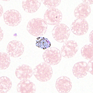 Case330_A.jpg