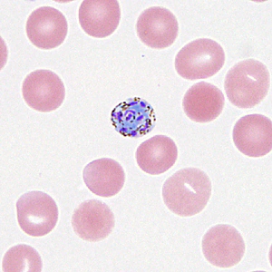Case330_C.jpg