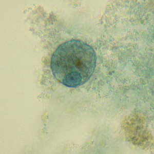 Case331_B.jpg