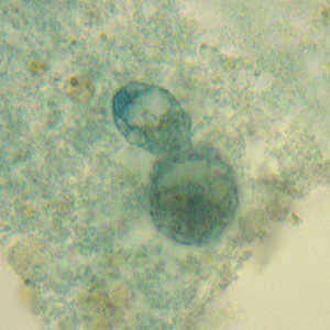 Case331_C.jpg