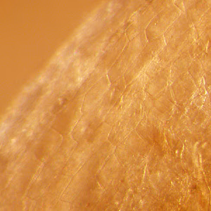 Case332_C.jpg