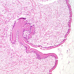 Case333_B.jpg