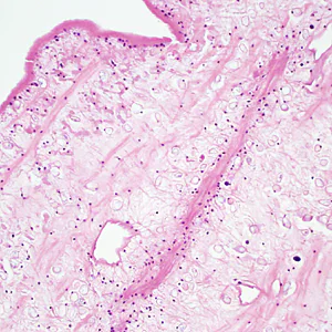Case333_C.jpg
