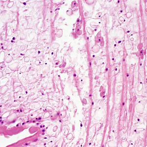 Case333_D.jpg