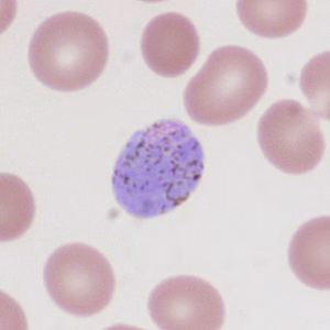 Case335_A.jpg