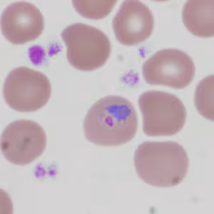 Case335_D.jpg