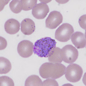 Case335_G.jpg
