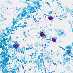 Case337_C.jpg