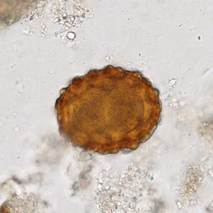 Case338_D.jpg