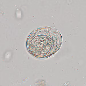 Case342_D.jpg
