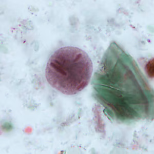 Case346_A.jpg