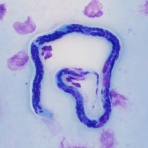 Case347_A.jpg
