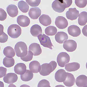 Case359_B.jpg