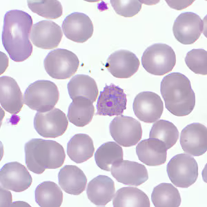 Case359_E.jpg