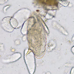 Case365_B.jpg