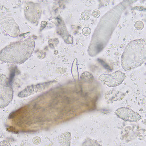 Case365_C.jpg