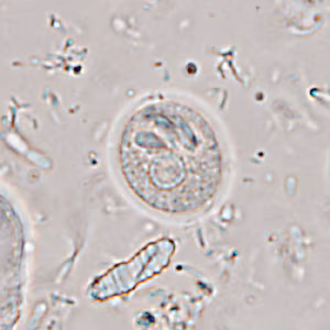 Case365_G.jpg
