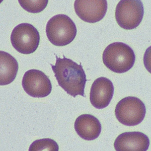 Case368_A.jpg