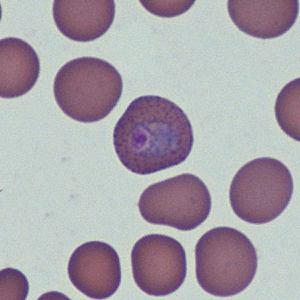 Case368_B.jpg