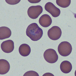 Case368_C.jpg