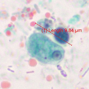 Case371_A.jpg