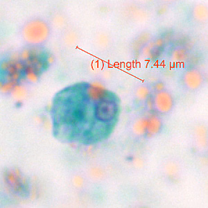 Case371_B.jpg