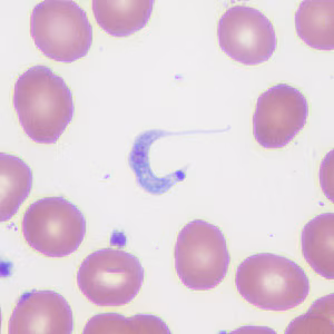 Case372_A.jpg
