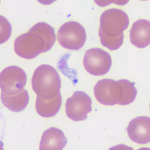 Case372_B.jpg