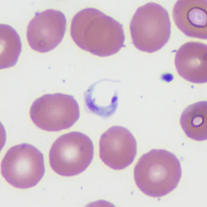 Case372_D.jpg