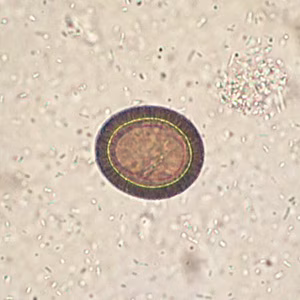 Case375_B.jpg