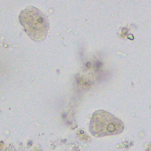 Case376_A.jpg