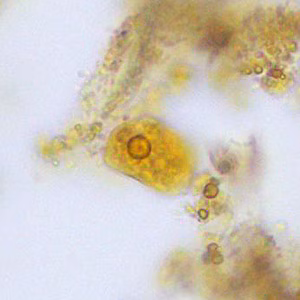 Case376_B.jpg