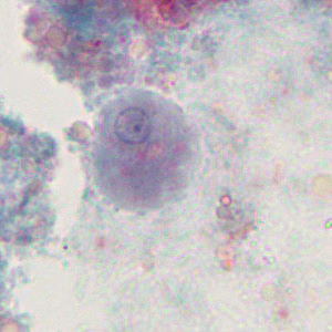 Case376_C.jpg